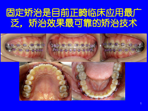 口腔正畸基础学PPT演示课件