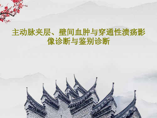 主动脉夹层、壁间血肿与穿通性溃疡影像诊断与鉴别诊断共72页PPT