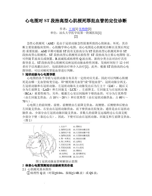 心电图对ST段抬高型心肌梗死罪犯血管的定位诊断