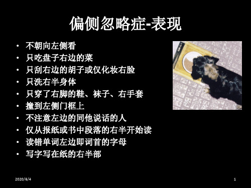 单侧忽略的概述、评定与治疗25页PPT