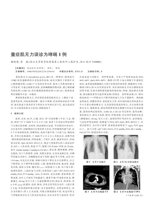 重症肌无力误诊为哮喘1例