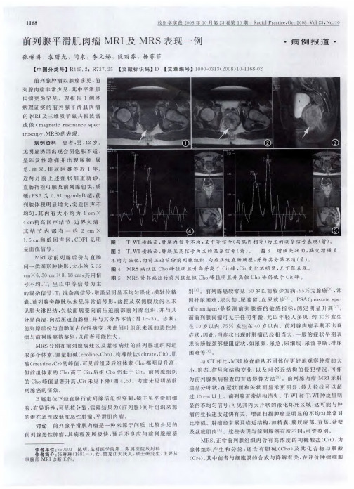 前列腺平滑肌肉瘤MRI及MRS表现一例