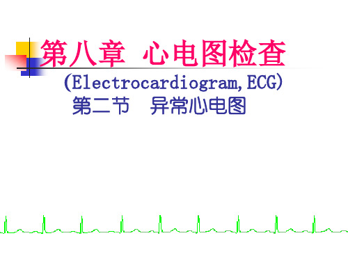 异常心电图心肌缺血心肌梗死精品PPT课件