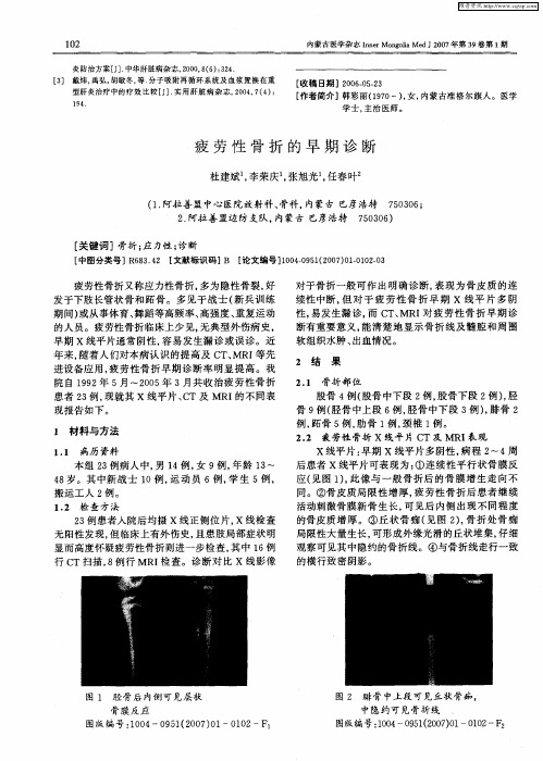 疲劳性骨折的早期诊断