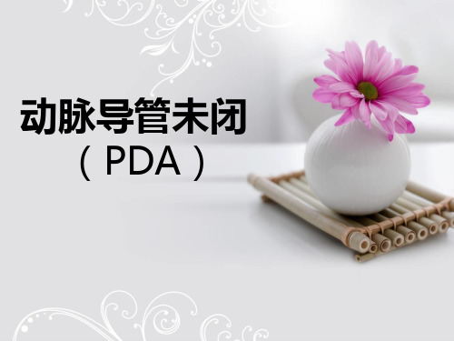 动脉导管未闭