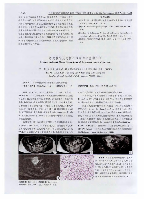 原发性盲肠恶性纤维组织细胞瘤1例
