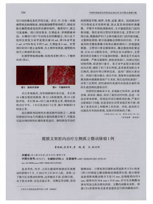 覆膜支架腔内治疗左侧孤立髂动脉瘤1例