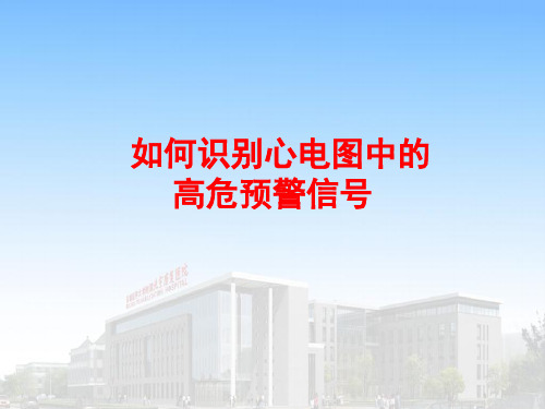 心电图预警高危信号