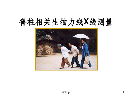 脊柱X线测量