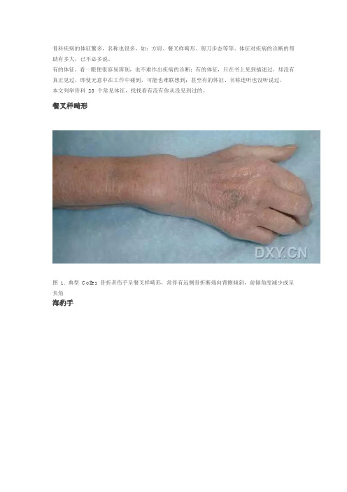 23个骨科常见体征 你都认识吗