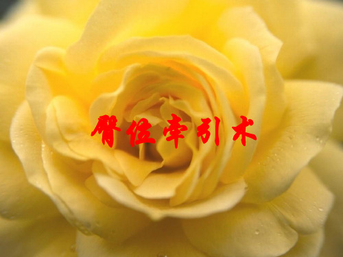 臀位牵引术