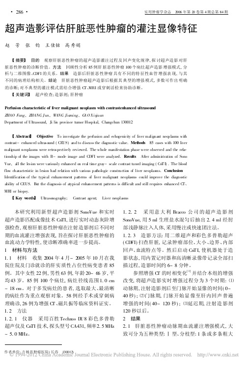 超声造影评估肝脏恶性肿瘤的灌注显像特征