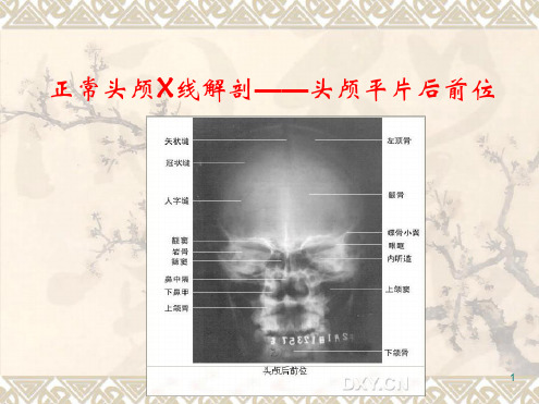 正常头颅X线解剖头颅平片后前位医学课件