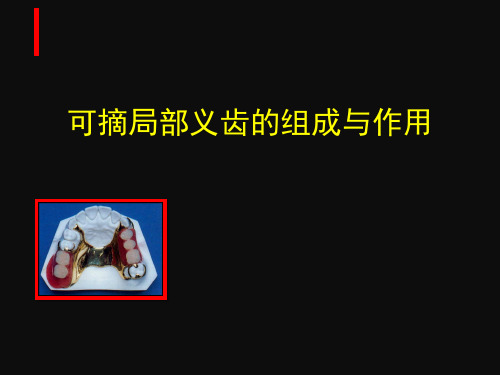 可摘局部义齿的组成与作用