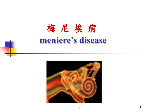 梅尼埃病及头晕详解(1)