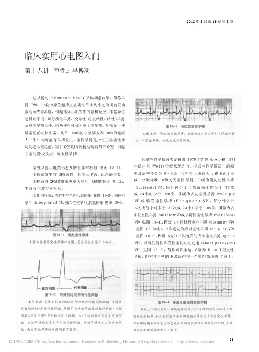 临床实用心电图入门  第十八讲  室性过早搏动