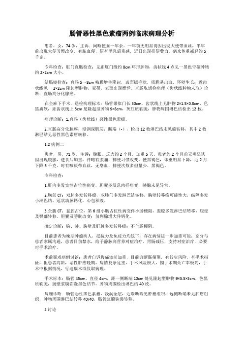 肠管恶性黑色素瘤两例临床病理分析