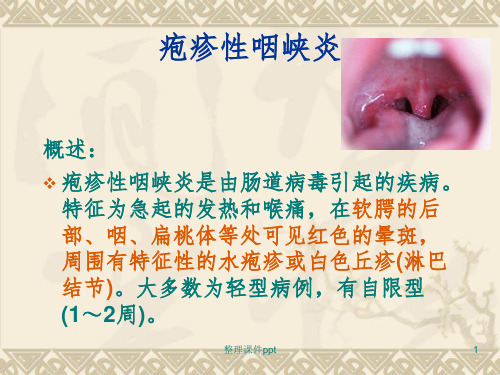 《疱疹性咽峡炎》PPT课件