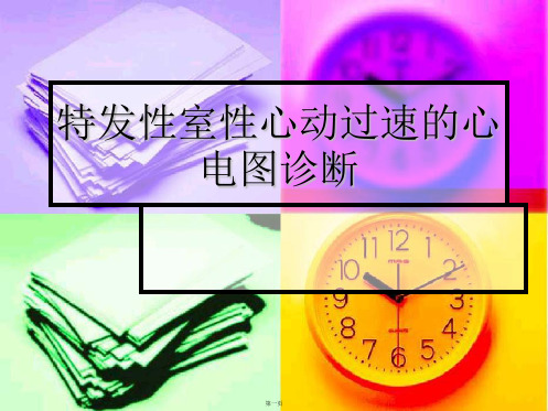 特发性室性心动过速的心电图诊断