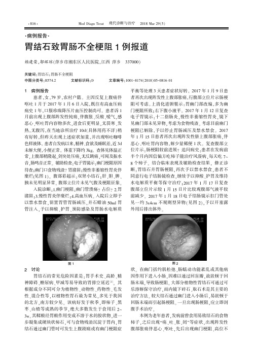胃结石致胃肠不全梗阻1例报道