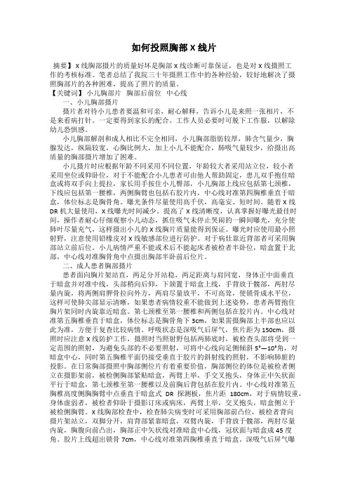如何投照胸部X线片