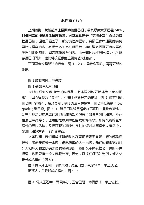 淋巴瘤（八）
