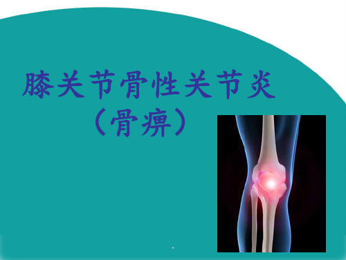 膝关节骨性关节炎pptPPT课件