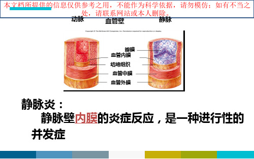 胺碘酮致静脉炎培训课件