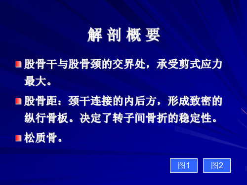 股骨转子间骨折概论