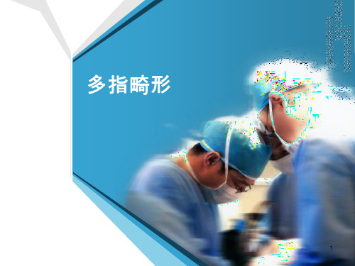 多指畸形ppt课件
