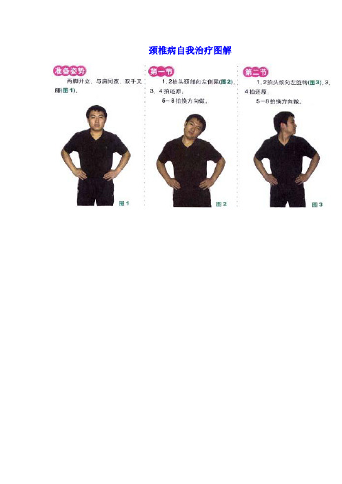 颈椎病自我治疗图要点