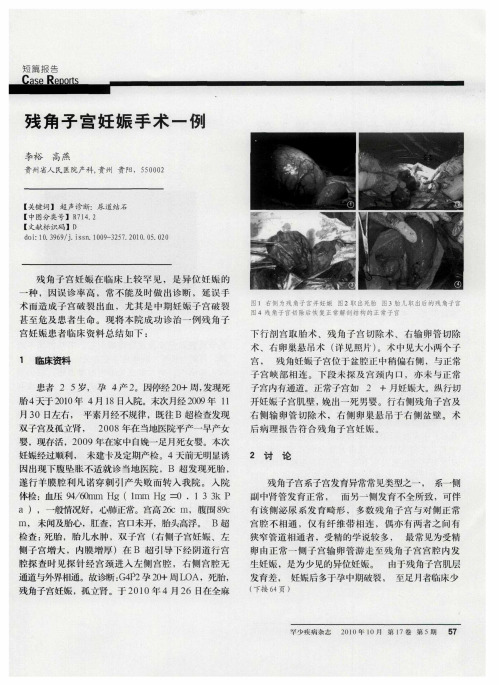 残角子宫妊娠手术一例