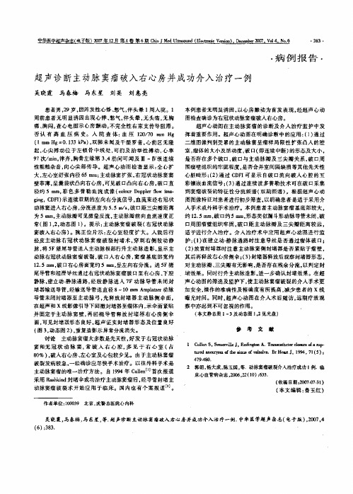 超声诊断主动脉窦瘤破入右心房并成功介入治疗一例