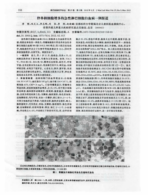 伴单核细胞增多的急性淋巴细胞白血病一例报道