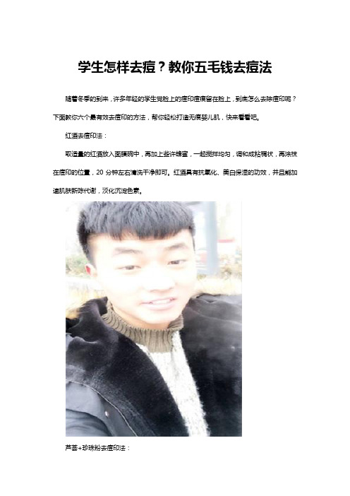 学生怎样去痘？教你五毛钱去痘法