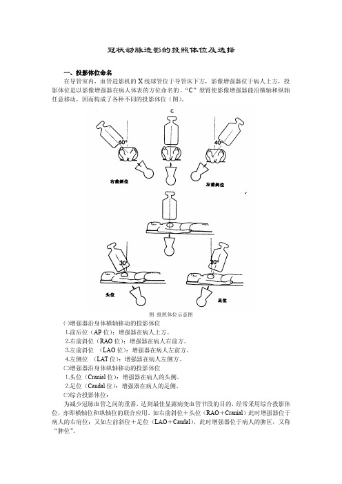 冠脉介入