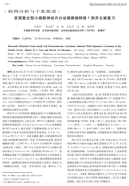 宫颈复合型小细胞神经内分泌癌胰腺转移1例并文献复习