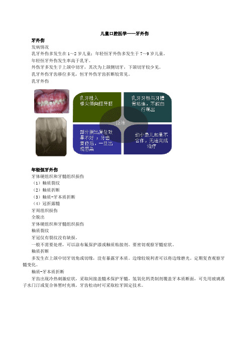 儿童口腔医学——牙外伤重点