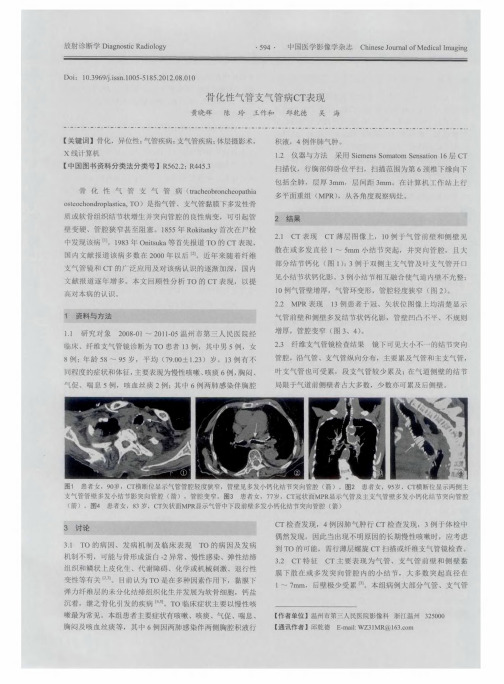 骨化性气管支气管病CT表现
