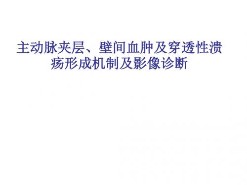 主动脉壁间血肿.ppt