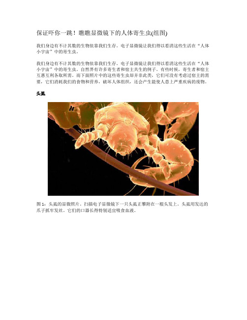 人体寄生虫--扫描电镜图解读