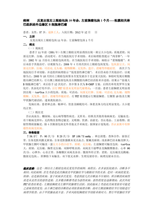 病例分析 粘膜相关结外B淋巴细胞淋巴瘤