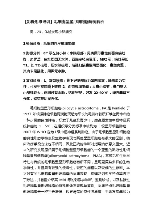 【影像思维培训】毛细胞型星形细胞瘤病例解析