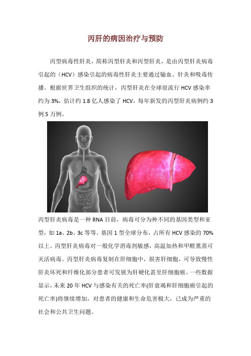 丙肝的病因治疗与预防