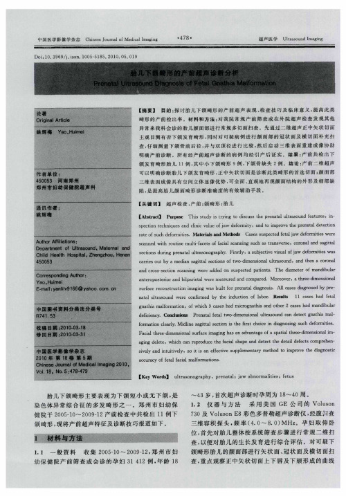 胎儿下颌畸形的产前超声诊断分析