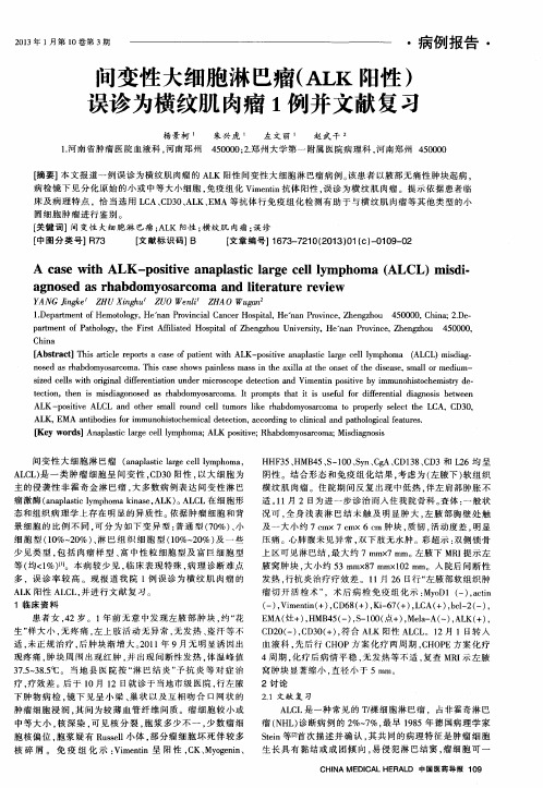 间变性大细胞淋巴瘤(ALK阳性)误诊为横纹肌肉瘤1例并文献复习