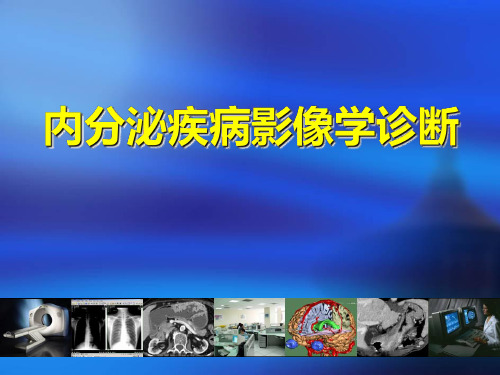 医学影像-精品推荐医学影像诊断PPT课件图文详解完整版-内分泌影像学