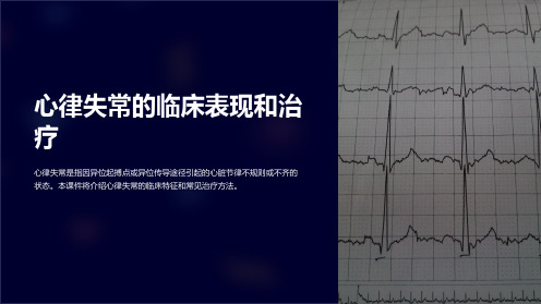 【内科学课件】心律失常的临床表现和治疗