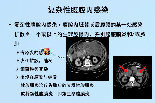 复杂性腹腔感染处理方法