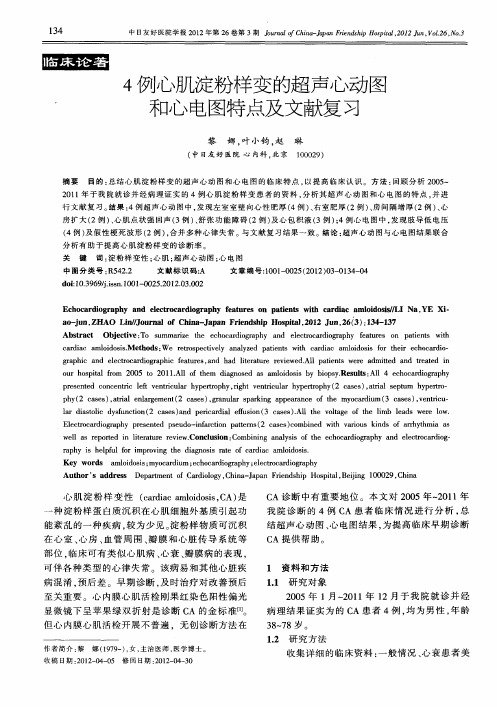 4例心肌淀粉样变的超声心动图和心电图特点及文献复习